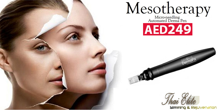 Mesotherapy Session