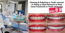 Teeth Care Services